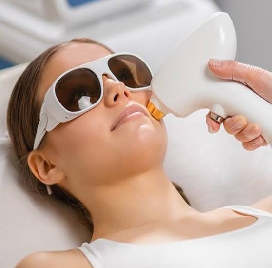 Laser Hair Removal